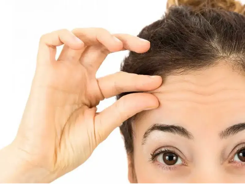بهترین سن بوتاکس