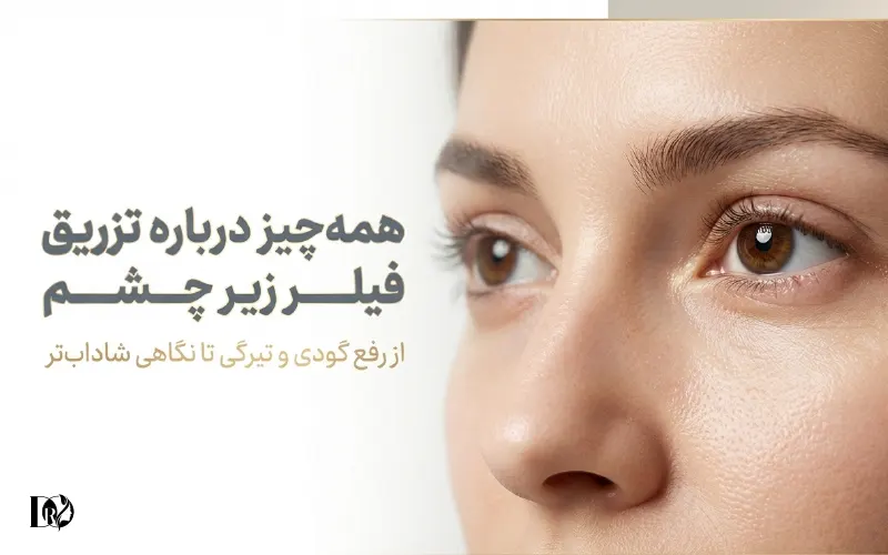تزریق فیلر زیر چشم تزریق فیلر زیر چشم