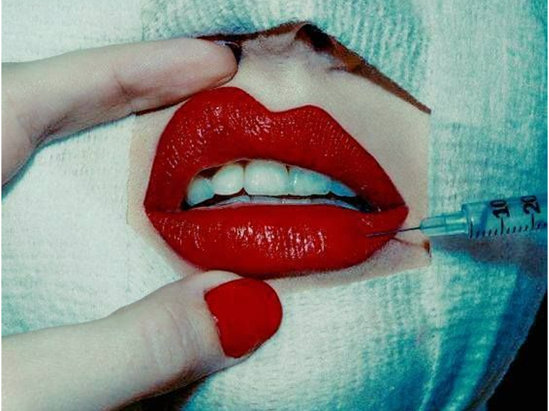 تزریق تمام صورت