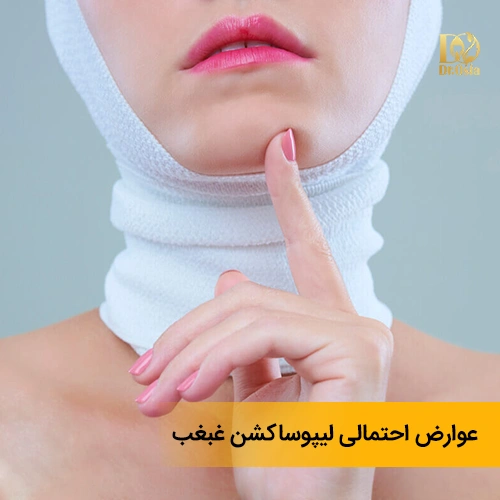 عوارض احتمالی لیپوساکشن غبغب