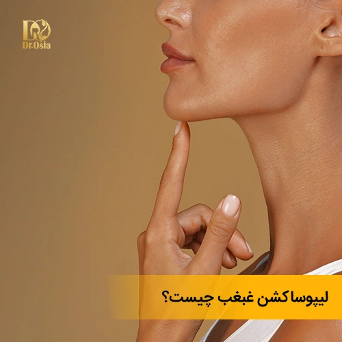 لیپوساکشن غبغب چیست؟ فراتر از یک تعریف ساده