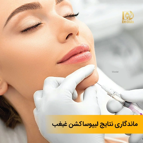 ماندگاری نتایج لیپوساکشن غبغب: آیا غبغب برمیگردد؟