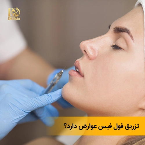 آیا تزریق فیلر فول فیس عوارض دارد؟