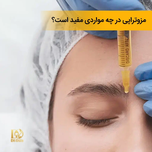 موارد مورد استفاده از مزوتراپی