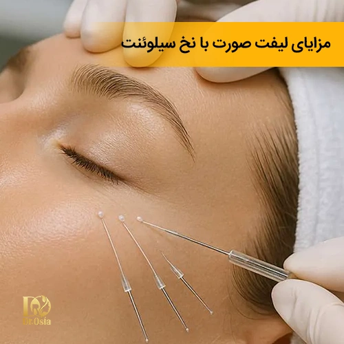 مزایای لیفت صورت با نخ سیلوئنت