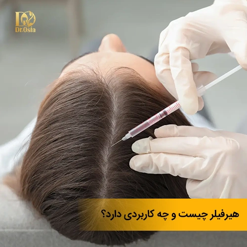 هیر فیلر چیست و چه کاربردی دارد؟