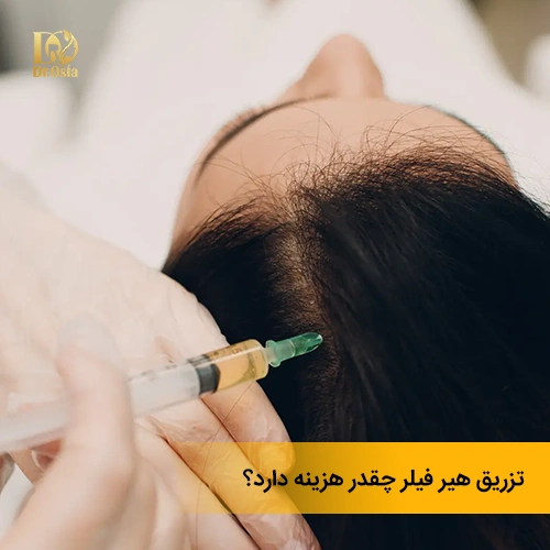 هزینه تزریق هیر فیلر چقدر است؟