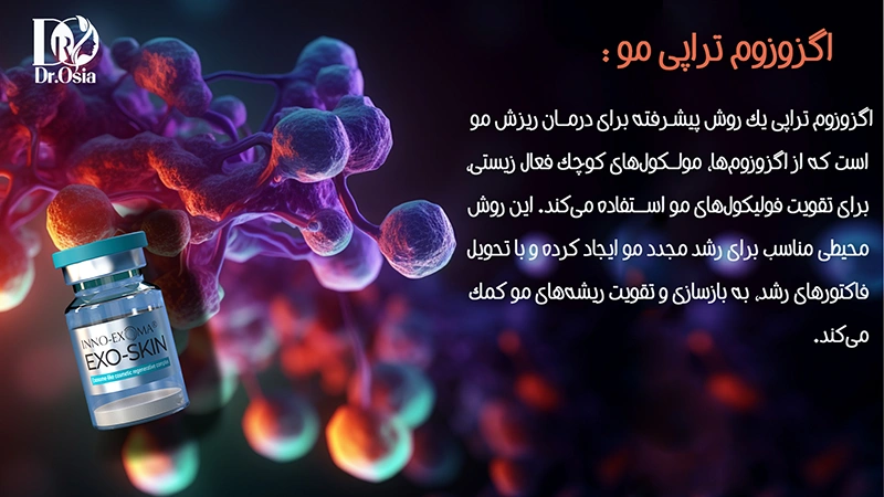آشنایی با اگزوزوم تراپی برای مو