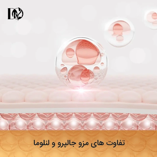 تفاوت های مزو جالپرو و لنلوما